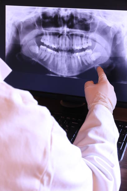 Best Broken or Chipped Tooth Repair in Paulina, LA